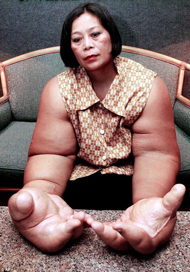 Thai woman's hands thought to be biggest in the world | Daily Mail Online