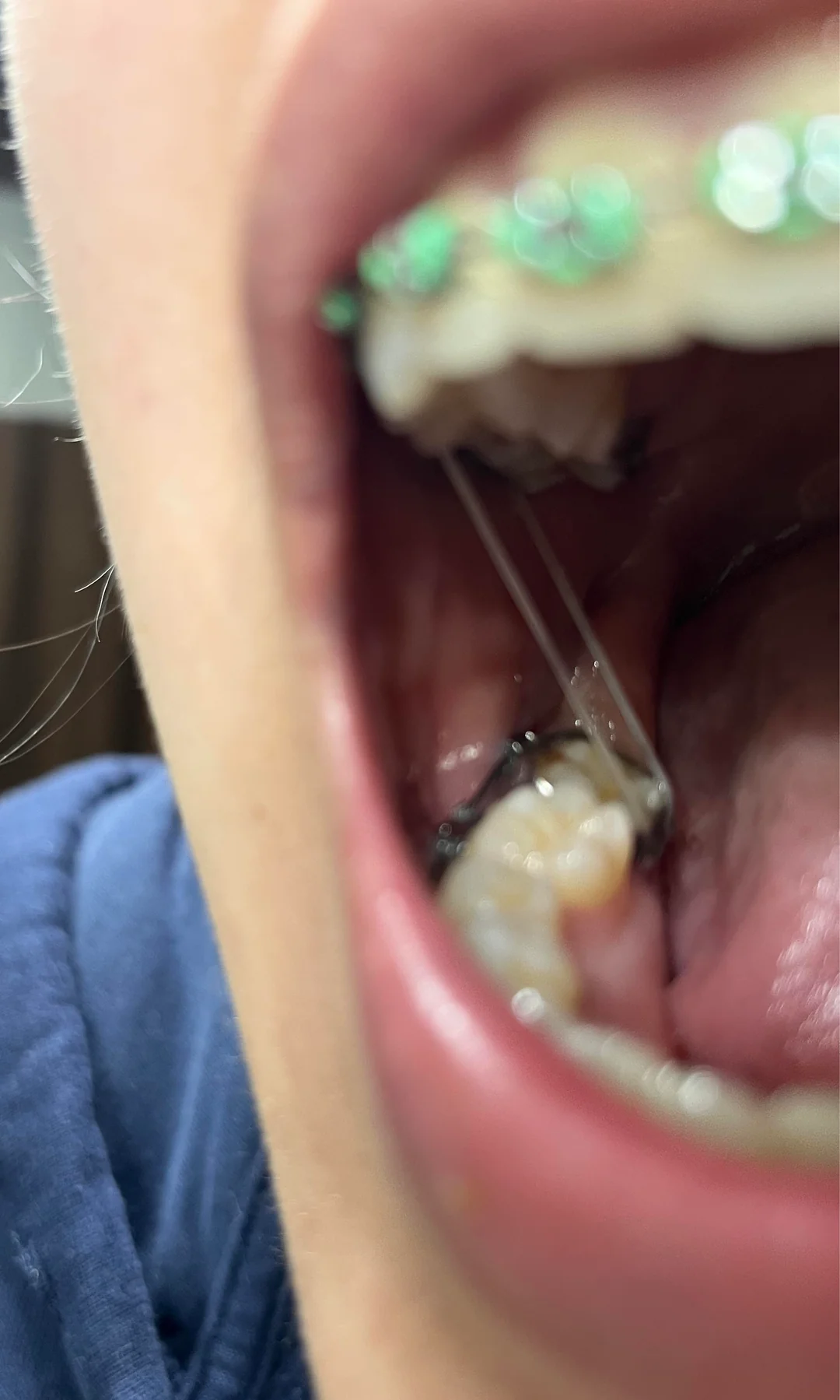 1754466194142 1754466194142