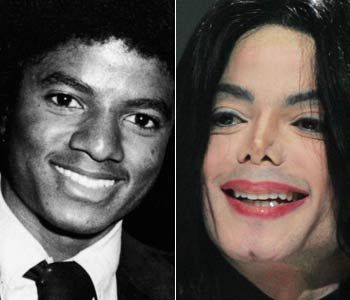 Michael Jackson Plastic Surgery - Before & After Pictures 2014 | Bad  celebrity plastic surgery, Celebrity plastic surgery, Plastic surgery gone  wrong