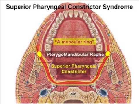 Image result for superior pharyngeal constrictor