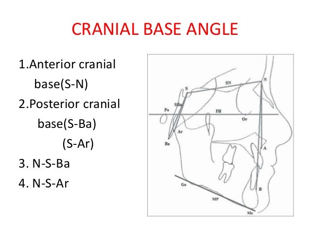 cranial-base-angle-in-relation-to-malocclusion-20-638.jpg