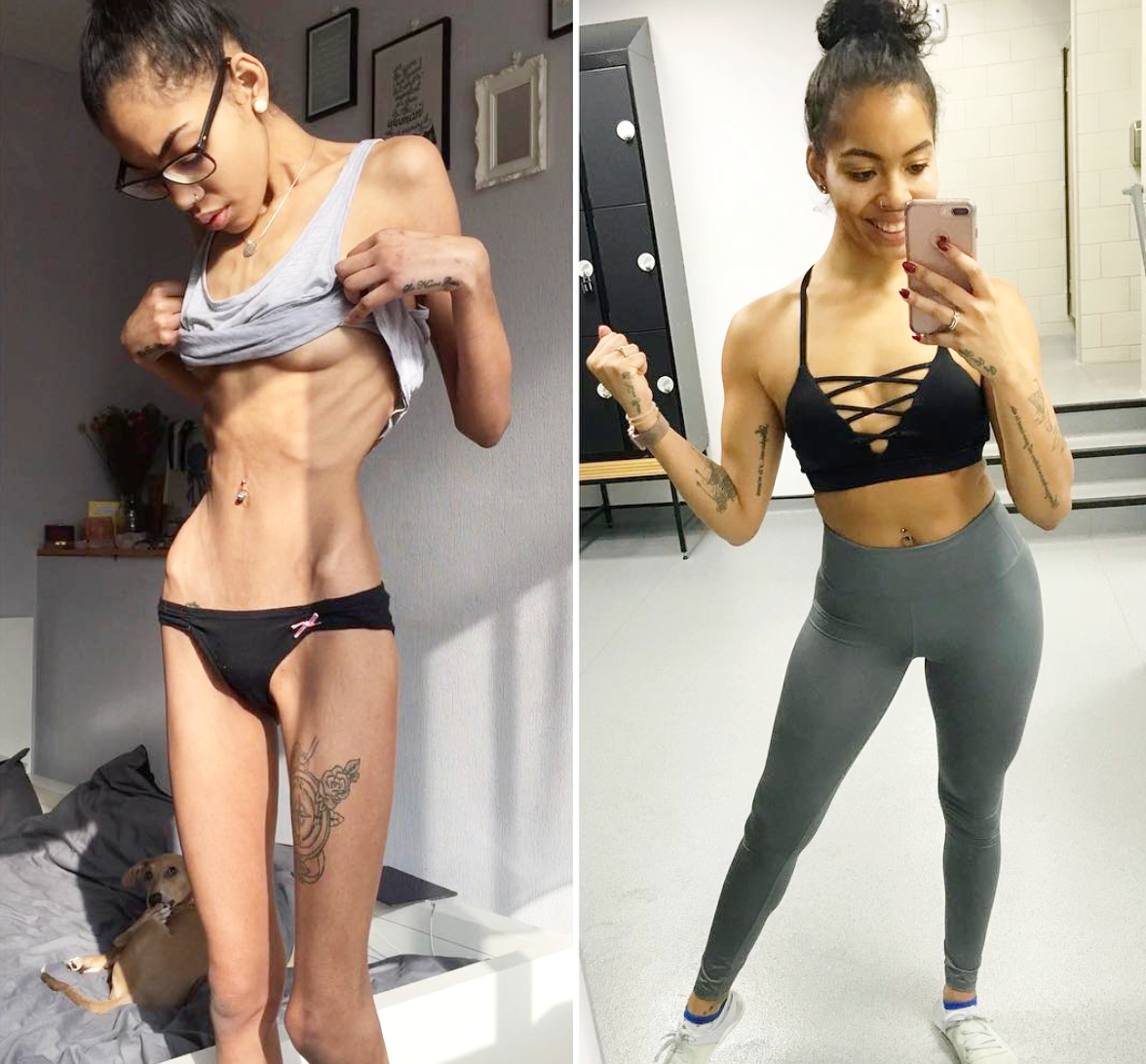 From Anorexia to Fitness Inspiration - How Holly Griffiths Transformed her  life — tameikag