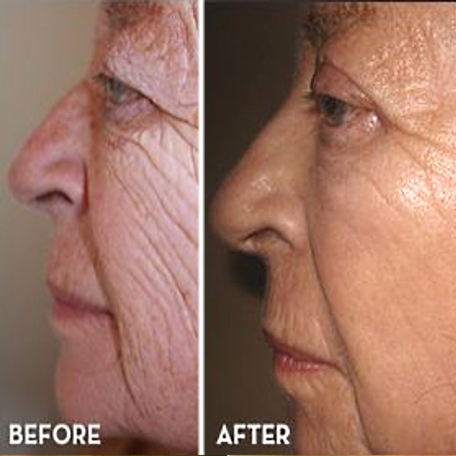 wrinkles-mature-woman.jpeg