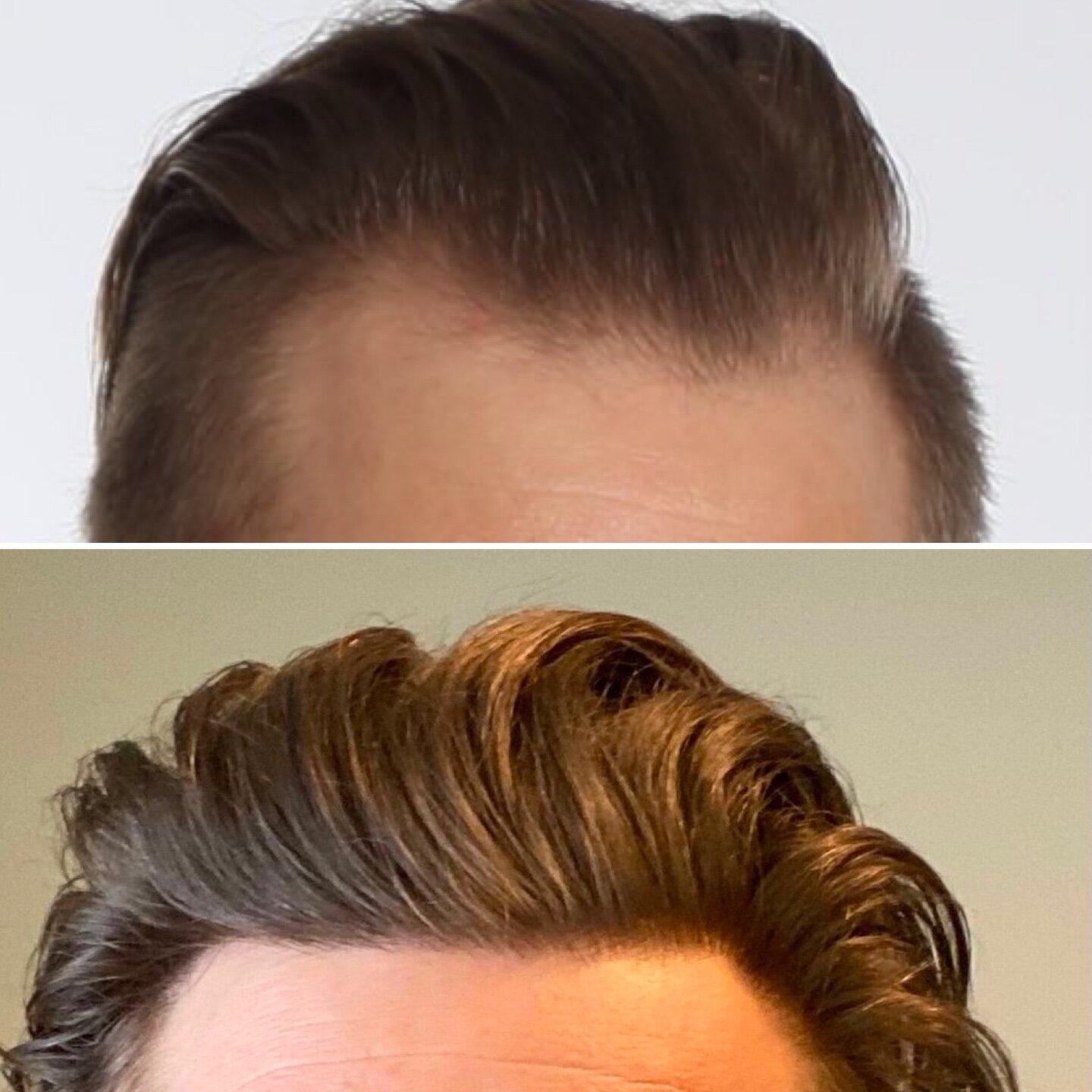 www.hairrestorationnetwork.com