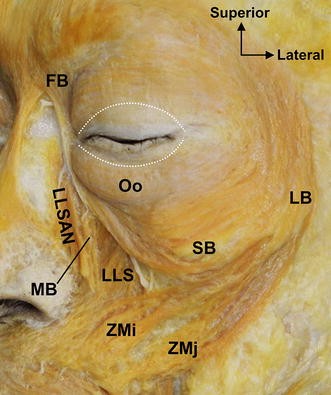 Image result for malaris muscle Image result for malaris muscle