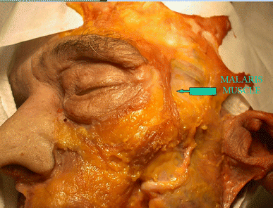 figure 2 figure 2