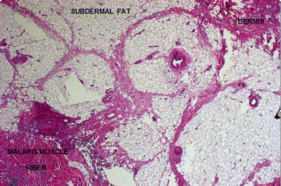 figure 3 figure 3