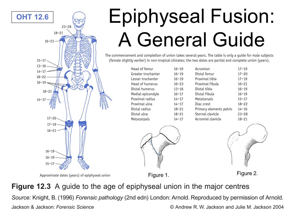 Epiphyseal+Fusion%3A+A+General+Guide.jpg
