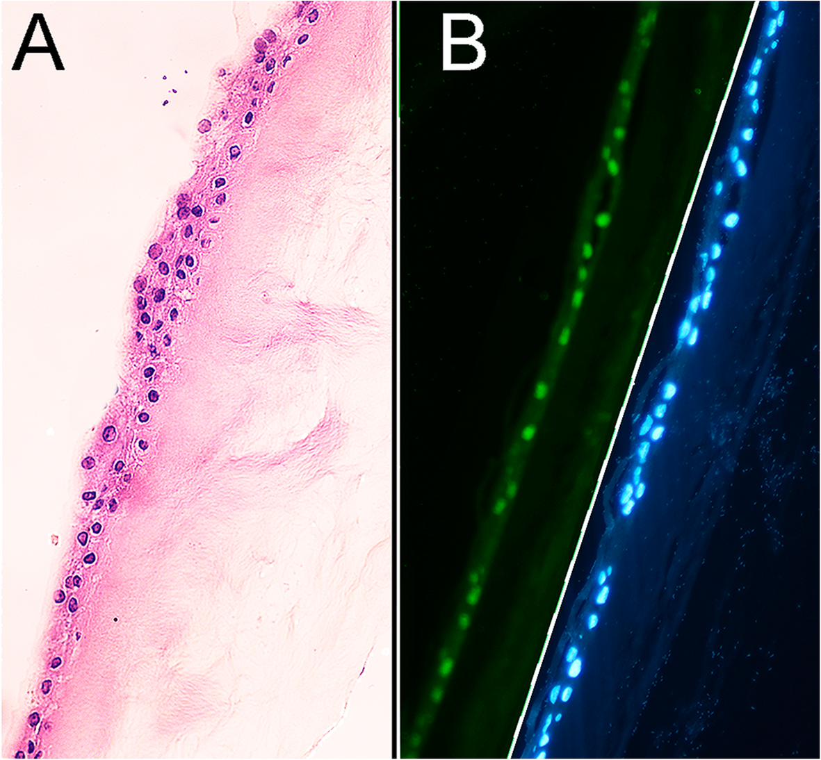 bmcophthalmol.biomedcentral.com