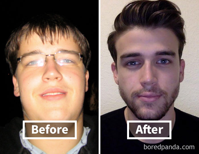 before-after-weight-loss-face-transformation-48-5a1d41971c377__700.jpg
