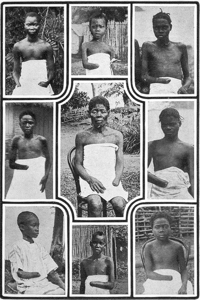 Atrocities in the Congo Free State - Wikipedia Atrocities in the Congo Free State - Wikipedia