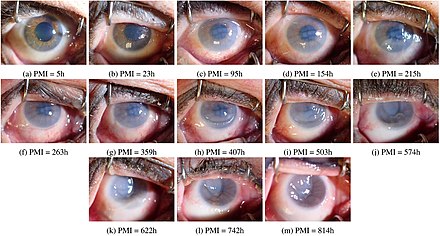 440px-Postmortem_changes_of_the_eye.jpg