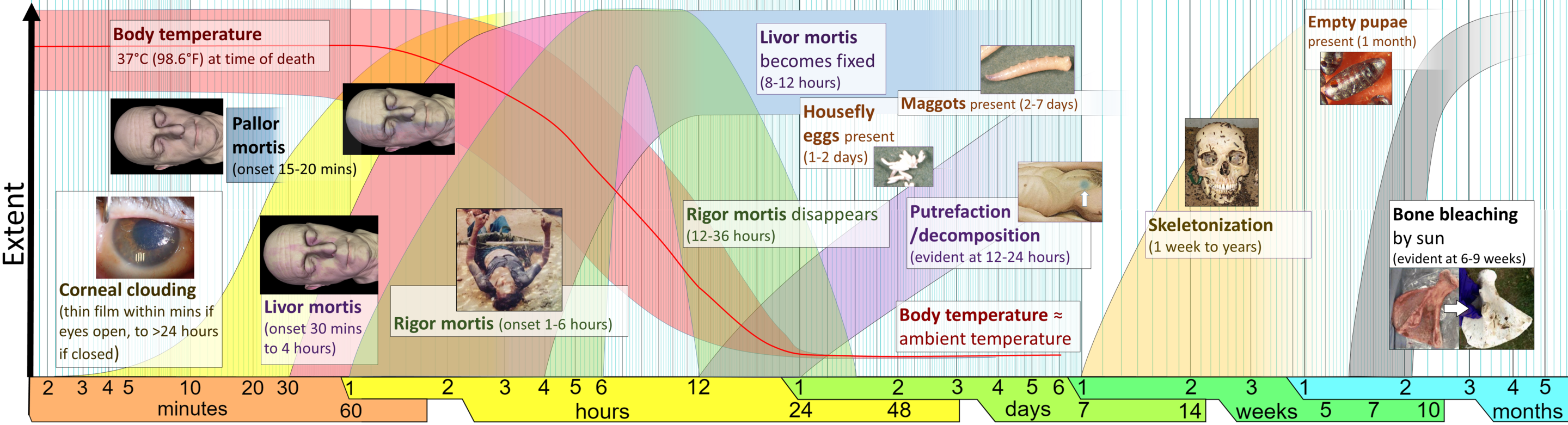 2880px-Postmortem_interval_changes_%28stages_of_death%29.png