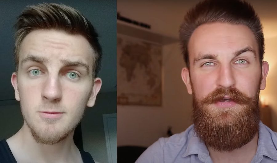 minox-beard-before-and-after-example-1.jpg