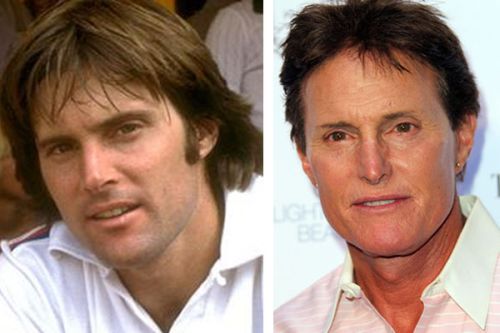 Bruce-Jenner-plastic-surgery-before-after.jpg