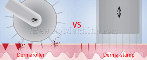 Dermaroller_VS_derma-stamp.jpg