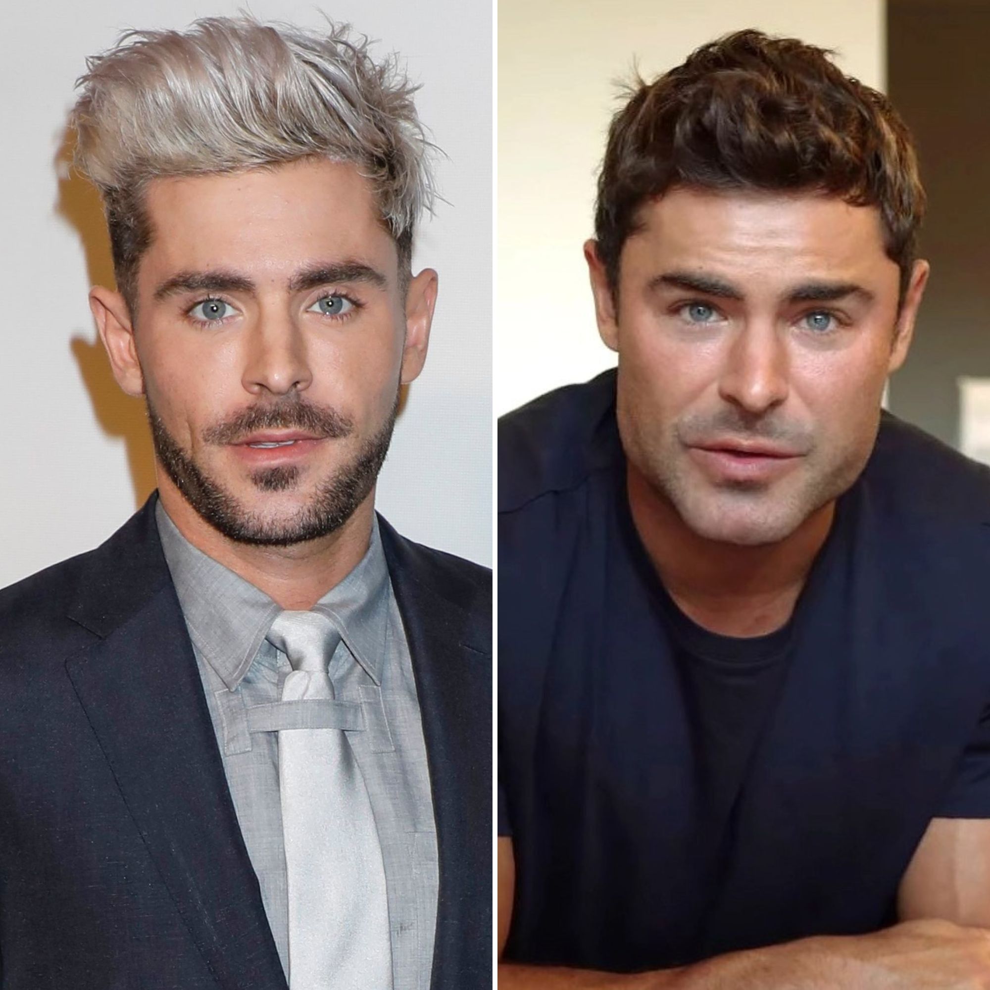 Did-Zac-Efron-Get-Plastic-Surgery-Everything-We-Know-.jpg