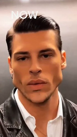 Male model showcases bizarre facial transformation after training his jaw